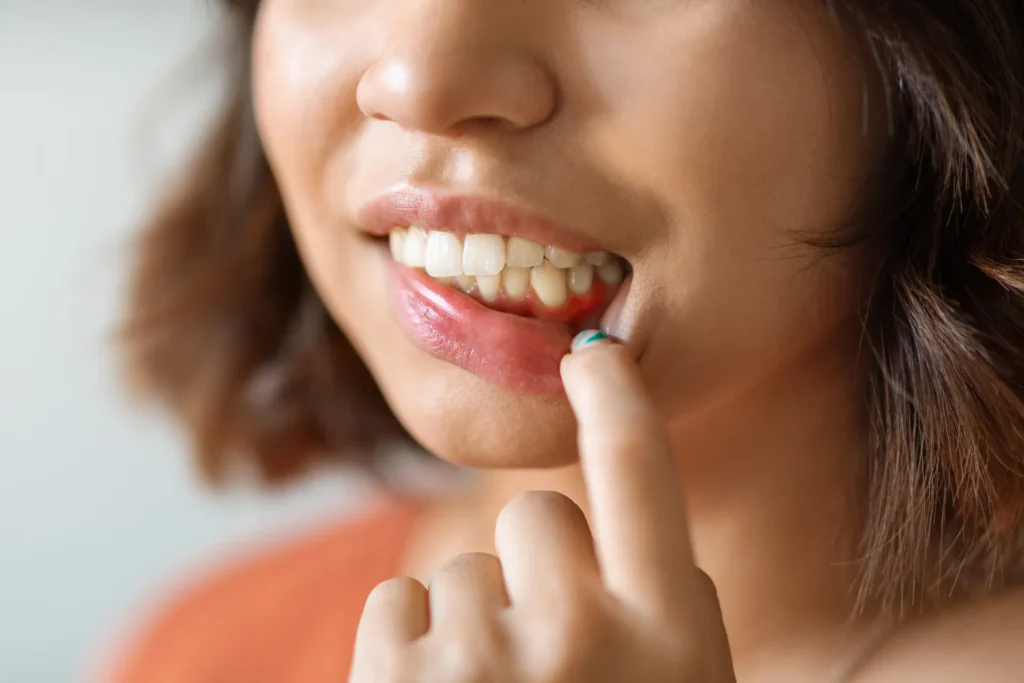 Donna che si sfiora la gengiva con un dito mostrando i denti