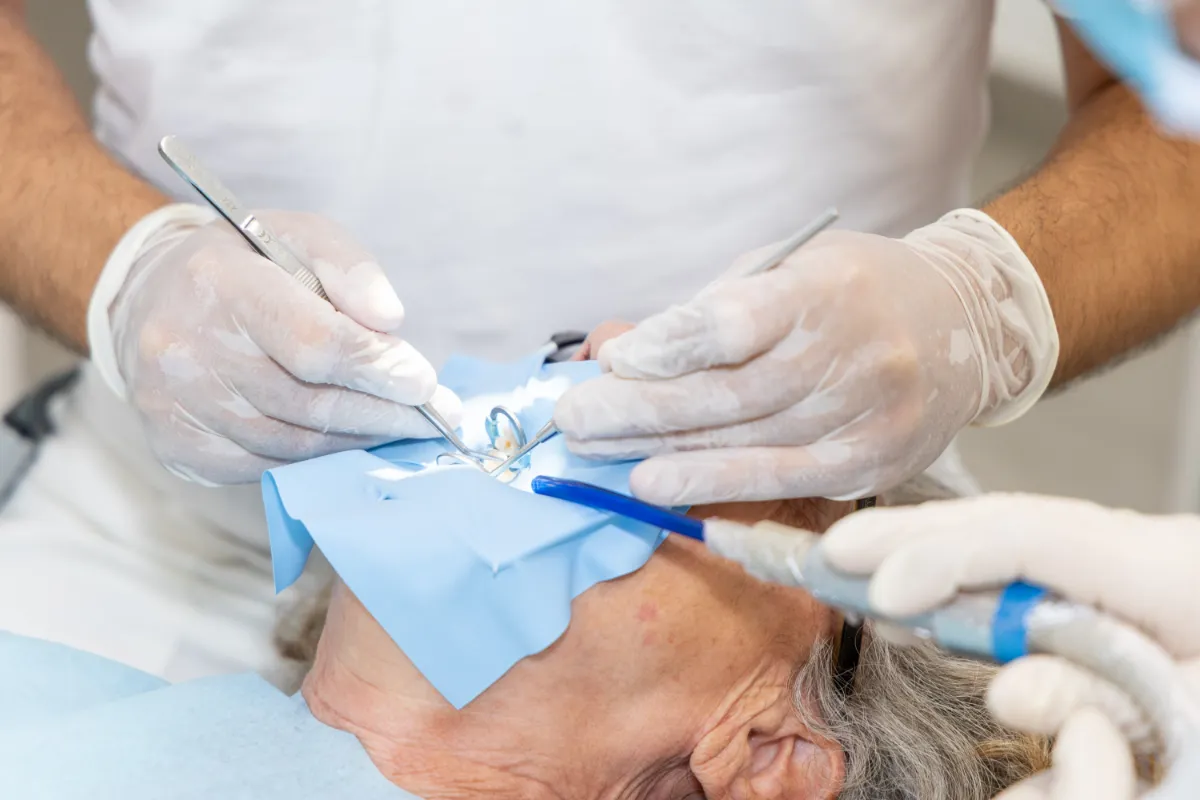 Cura di un dente isolato con la diga di gomma